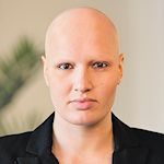 Kundin Z. mit totalem Haarverlust (Chermotherapie)